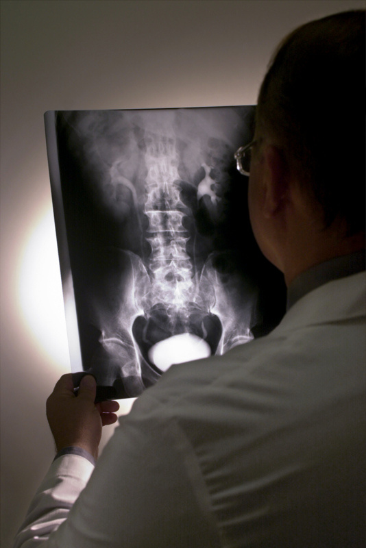 bones-doctor-x-ray.jpg