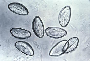 pinworm-eggs-wikipedia.jpeg